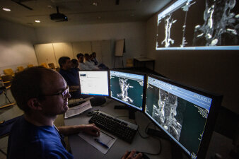 Eine Person sitzt vor Bildschirmen und betrachtet Bilder eines CTs.