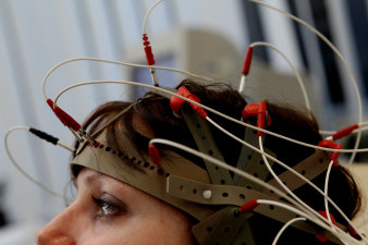 Foto: Hirnströme © HELIOS Kliniken GmbH Kopf mit Elektroden