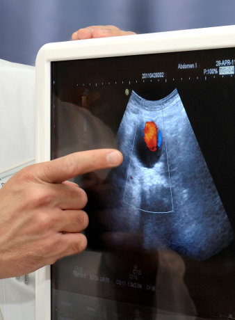 Foto: Echokardiografie © HELIOS Kliniken GmbH Echokardiographie: Bild einer Echokardiografie