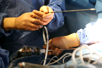 Foto: Thoraxchirurgie © HELIOS Kliniken GmbH Hände mit Geräten und Kabeln