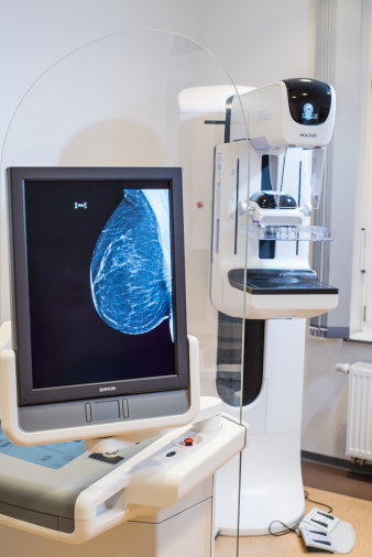 Foto: 3D-Bild Mammographie Screening © Mammographie Screening Thüringen Nord West 3D- Ansicht einer weiblichen Brust auf einem Monitor.