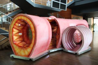 Foto: Arterienmodell © HELIOS Kliniken GmbH mannshohes Modell