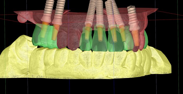Foto: 3D-Bild eines Gebisses © Dr. Frank Schaefer 3-dimensionales buntes Bild eines menschlichen Gebisses mit Zahnkronen