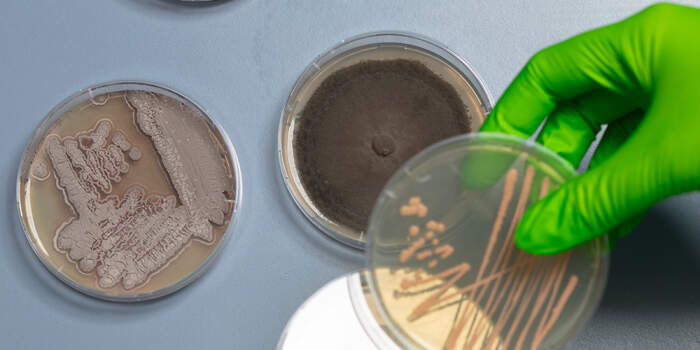 Mikrobiologische Spurensuche – Wer lebt mit der Pflanze?