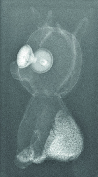 Foto: Röntgenbild © Helios Kliniken GmbH Schwarzweiß-Röntgenbild vom Teddy