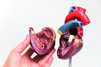 Foto: Herzschrittmacher- und Defibrillatortherapie © Helios Kliniken GmbH Herzmodell im Schnitt